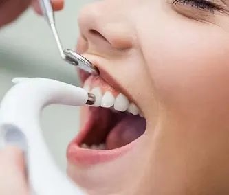 Oral Prophylaxis