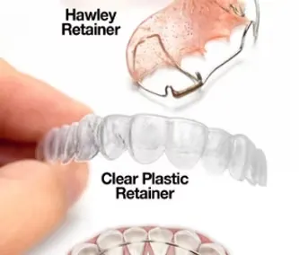 Retainers